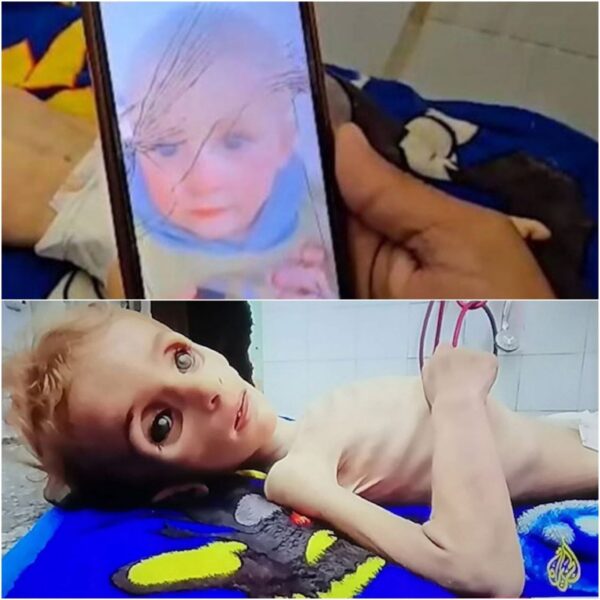 وفاة 69 طفلا جوعا في غزة