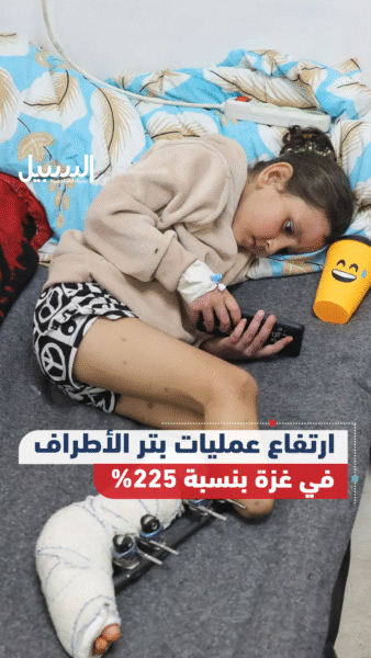 ارتفاع عمليات بتر الأطراف في غزة بنسبة 225% جراء العدوان الإسرائيلي