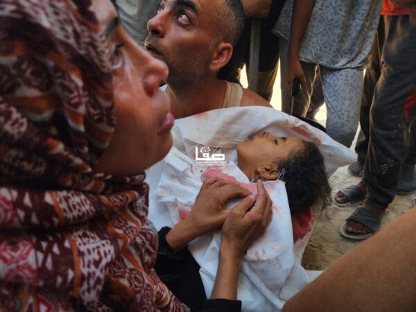 7 شهداء في غزة اليوم بالجوع