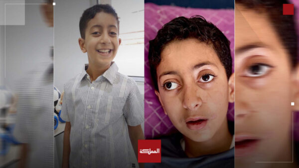 محمد معمر.. طفل غزي يعالج في الأردن يستعيد بصره وقدرته على المشي