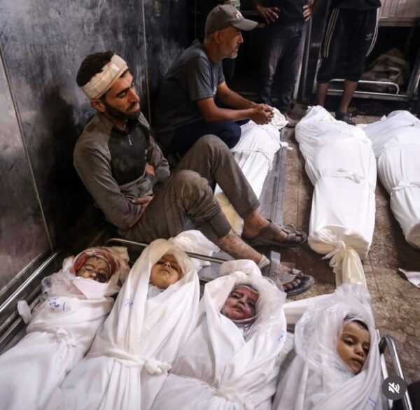 3 شهداء و35 مصاباً في غزة خلال يوم