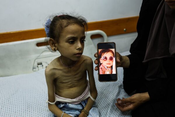 20 ألف مريض في غزة يواجهون خطر الموت بسبب منعهم من السفر للعلاج